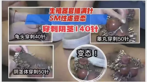 重口变态系列！胆小勿进，生殖器官被插满针，SM性虐变态穿针140针！